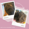 Vital Root Hair Growth Elixir: Natural DHT Blocker for Thicker, Fuller Hair